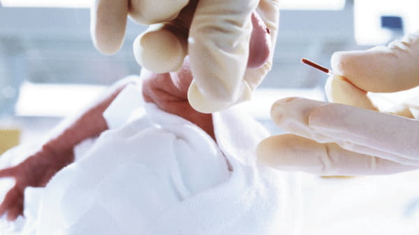 Illustration d’un capillaire Clinitube utilisé