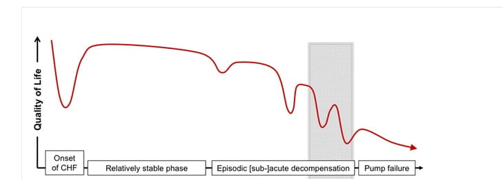 Disease progression. Clinical course of heart failure  Greenhalgh et al. BMC Cardiovascular Disorders (2017) 17:156